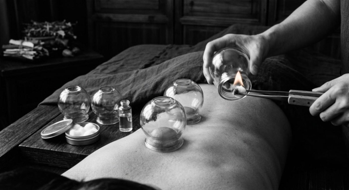 Cupping therapy